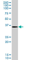 STRADA / LYK5 Antibody - LYK5 monoclonal antibody (M02), clone 4E4. Western blot of LYK5 expression in HeLa NE.