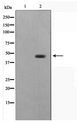 STRADA / LYK5 Antibody - Western blot of HepG2 cell lysate using STRAD Antibody