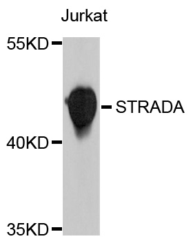 STRADA / LYK5 Antibody - Western blot analysis of extracts of Jurkat cells, using STRADA antibody at 1:1000 dilution. The secondary antibody used was an HRP Goat Anti-Rabbit IgG (H+L) at 1:10000 dilution. Lysates were loaded 25ug per lane and 3% nonfat dry milk in TBST was used for blocking. An ECL Kit was used for detection and the exposure time was 10s.