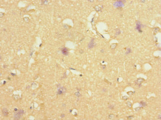 STRADA / LYK5 Antibody - Immunohistochemistry of paraffin-embedded human brain tissue at dilution 1:100