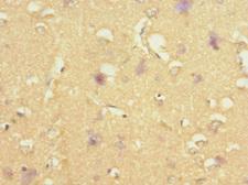 STRADA / LYK5 Antibody - Immunohistochemistry of paraffin-embedded human brain tissue at dilution 1:100