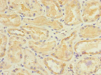 STRADA / LYK5 Antibody - Immunohistochemistry of paraffin-embedded human kidney tissue at dilution 1:100