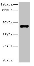 STRADA / LYK5 Antibody - Western blot All Lanes: STRADA antibody IgG at 1.98ug/ml+ Rat heart tissue Secondary Goat polyclonal to rabbit IgG at 1/10000 dilution Predicted band size: 49,39,44,34,42,35 kDa Observed band size: 48 kDa