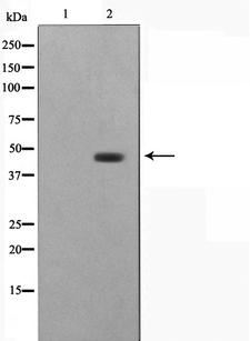 STRADA / LYK5 Antibody - Western blot analysis on HepG2 cell lysates using STRAD antibody. The lane on the left is treated with the antigen-specific peptide.