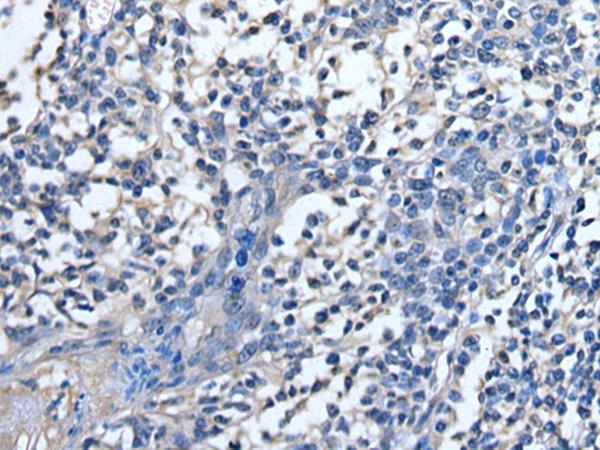 STRADA / LYK5 Antibody - Immunohistochemistry of paraffin-embedded Human tonsil tissue  using STRADA Polyclonal Antibody at dilution of 1:85(×200)