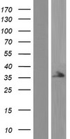 STRADA / LYK5 Protein - Western validation with an anti-DDK antibody * L: Control HEK293 lysate R: Over-expression lysate
