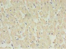 STRADB / ALS2CR2 Antibody - Immunohistochemistry of paraffin-embedded human heart tissue using antibody at 1:100 dilution.  This image was taken for the unconjugated form of this product. Other forms have not been tested.
