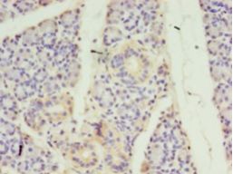 STRADB / ALS2CR2 Antibody - Immunohistochemistry of paraffin-embedded human pancreas tissue using antibody at 1:100 dilution.  This image was taken for the unconjugated form of this product. Other forms have not been tested.