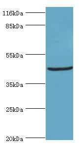STRADB / ALS2CR2 Antibody - Western blot. All lanes: STRADB antibody at 2 ug/ml+HeLa whole cell lysate. Secondary antibody: Goat polyclonal to rabbit at 1:10000 dilution. Predicted band size: 47 kDa. Observed band size: 47 kDa.  This image was taken for the unconjugated form of this product. Other forms have not been tested.