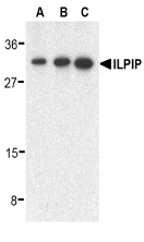 STRADB / ALS2CR2 Antibody - Western blot of ILPIP in human heart lysate with ILPIP antibody at 0.5 (lane A), 1 (lane B), and 2 (lane C) ug/ml, respectively.