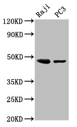STRADB / ALS2CR2 Antibody - Western Blot Positive WB detected in: Raji whole cell lysate, PC-3 whole cell lysate All lanes: STRADB antibody at 3µg/ml Secondary Goat polyclonal to rabbit IgG at 1/50000 dilution Predicted band size: 48, 43, 32 kDa Observed band size: 48 kDa