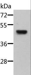 STRADB / ALS2CR2 Antibody - Western blot analysis of Mouse pancreas tissue, using STRADB Polyclonal Antibody at dilution of 1:500.
