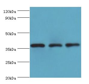 STRAP / MAWD Antibody - Western blot. All lanes: STRAP antibody at 8 ug/ml. Lane 1: HepG2 whole cell lysate. Lane 2: HeLa whole cell lysate. Lane 3: mouse brain tissue. Secondary antibody: Goat polyclonal to rabbit at 1:10000 dilution. Predicted band size: 38 kDa. Observed band size: 38 kDa.