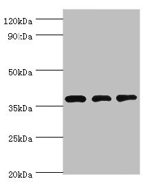 STRAP / MAWD Antibody - Western blot All lanes: STRAP antibody at 8µg/ml Lane 1: HepG2 whole cell lysate Lane 2: Hela whole cell lysate Lane 3: Mouse brain tissue Secondary Goat polyclonal to rabbit IgG at 1/10000 dilution Predicted band size: 39, 40 kDa Observed band size: 39 kDa