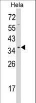 STRAP / MAWD Antibody - Western blot of STRAP Antibody in HeLa cell line lysates (35 ug/lane). STRAP (arrow) was detected using the purified antibody.