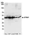 STRAP / MAWD Antibody - Detection of human and mouse STRAP by western blot. Samples: Whole cell lysate (50 µg) from HeLa, HEK293T, Jurkat, mouse TCMK-1, and mouse NIH 3T3 cells prepared using NETN lysis buffer. Antibodies: Affinity purified rabbit anti-STRAP antibody used for WB at 0.1 µg/ml. Detection: Chemiluminescence with an exposure time of 10 seconds.
