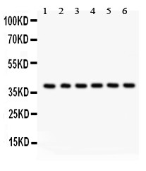 STRAP / MAWD Antibody - Unrip antibody Western blot. All lanes: Anti Unrip at 0.5 ug/ml. Lane 1: Rat Brain Tissue Lysate at 50 ug. Lane 2: HEPG2 Whole Cell Lysate at 40 ug. Lane 3: SMMC Whole Cell Lysate at 40 ug. Lane 4: U87 Whole Cell Lysate at 40 ug. Lane 5: Human Placenta Tissue Lysate at 50 ug. Lane 6: HELA Whole Cell Lysate at 40 ug. Predicted band size: 38 kD. Observed band size: 38 kD.