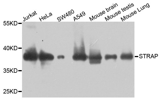 STRAP / MAWD Antibody - Western blot analysis of extract of various cells.