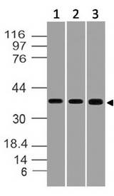 STRAP / MAWD Antibody - Fig-1: Western blot analysis of STRAP. Anti-STRAP antibody was used at 1 µg/ml on (1) Hela, (2) Jurkat and (3) HCT-116 lysates.