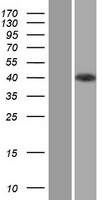 STRAP / MAWD Protein - Western validation with an anti-DDK antibody * L: Control HEK293 lysate R: Over-expression lysate