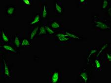 STRBP / SPNR Antibody - Immunofluorescent analysis of Hela cells using STRBP Antibody at dilution of 1:100 and Alexa Fluor 488-congugated AffiniPure Goat Anti-Rabbit IgG(H+L)
