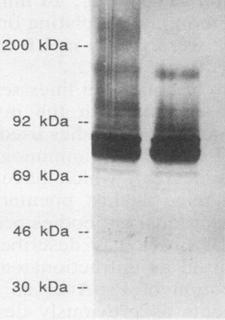 Streptococcus pneumoniae Antibody - Immunoblot of recombinant pneumococcal surface protein A (PspA). Lanes: 1 and 2, phage lysate from full-length PspA+ clone with and without induction by isopropyl-ß-D-thiogalactopyranoside (IPTG), respectively; 3, cell wall extract from pneumococcal type 2 strain D39.   (McDaniel L. et al. 1991 PspA, A surface protein of Streptococcus pneumoniae, is capable of eliciting protection against Pneumococci of more than one capsular type. Infection and Immunity 59: 222-228.)