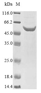 Pneumolysin Protein - (Tris-Glycine gel) Discontinuous SDS-PAGE (reduced) with 5% enrichment gel and 15% separation gel.