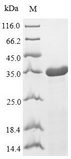 50S ribosomal protein L7/L12 Protein - (Tris-Glycine gel) Discontinuous SDS-PAGE (reduced) with 5% enrichment gel and 15% separation gel.