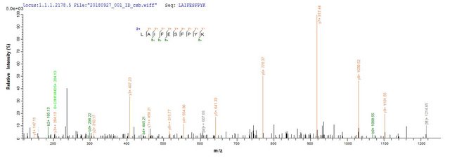 acpS Protein - Based on the SEQUEST from database of Baculovirus host and target protein, the LC-MS/MS Analysis result of Recombinant Streptococcus pyogenes serotype M28 Holo-[acyl-carrier-protein] synthase(acpS) could indicate that this peptide derived from Baculovirus-expressed Streptococcus pyogenes serotype M28 (strain MGAS6180) acpS.