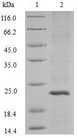 APRT Protein - (Tris-Glycine gel) Discontinuous SDS-PAGE (reduced) with 5% enrichment gel and 15% separation gel.