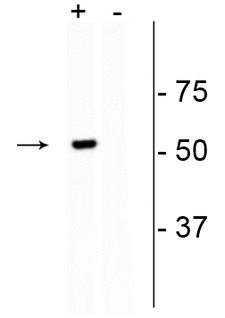 Streptococcus pyogenes CRISPR-associated endonuclease Cas9/Csn1 Antibody - Western blot of GFP-Cas9 transfected HEK293 cell lysate (+) showing specific immunolabeling of the ~53 kDa GFP-Cas9 fusion protein. Labeling is absent in the untransfected lysate (-). Click here to view our Western blotting and lysate preparation protocols.