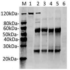 Streptococcus pyogenes CRISPR-associated endonuclease Cas9/Csn1 Antibody - Immunoprecipitation of SaCas9 from Hela cell transfected with PX458 (SaCas9(BB)-2A-GFP) by using SaCas9 Antibody (11C12). Predicted band size: 124 kDa. Loading: Lane 1: Hela cell lysate transfected with PX458 (SaCas9(BB)-2A-GFP) 50µg (Input). Lane 2: Protein A MagBeads (20µl) + Purified antibody (10µg) + Hela cell lysate transfected with PX458 (SaCas9(BB)-2A-GFP) (200µg). Lane 3: Protein A MagBeads (20µl) + Purified antibody (10µg) + Hela cell lysate (200µg). Lane 4: Protein A MagBeads (20µl) + Mouse IgG (10µg) + Hela cell lysate transfected with PX458 (SaCas9(BB)-2A-GFP) (200µg). Lane 5: Protein A MagBeads (20µl) + Mouse IgG (10µg) + Hela Cell lysate (200µg). Lane 6: Hela Cell lysate (50µg). Primary Antibody: SaCas9 Antibody (11C12) 1 µg/ml. Secondary antibody: Goat anti-Mouse IgG (H&L) [IRDye800] 0.125 µg/ml.
