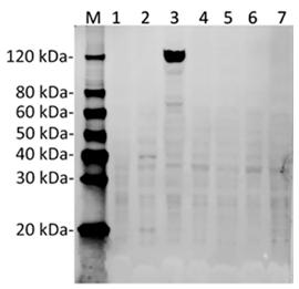Streptococcus pyogenes CRISPR-associated endonuclease Cas9/Csn1 Antibody - Western Blot analysis of Hela transfected with various plasmids with SaCas9 Antibody (11C12). The different Hela transfected with various plasmids indicate the minimum cross reaction of the antibody. Predicted band size: 124 kDa. Loading: Lane 1: 50µg Hela cell lysate transfected with StCas9(BB)-2A-GFP (G3ECR1, Streptococcus thermophiles). Lane 2: 50µg Hela cell lysate transfected with pSpCas9(BB)-2A-GFP (PX458, Q99ZW2, Streptococcus pyogenes serotype M1). Lane 3: 50µg Hela cell lysate transfected with SaCas9(BB)-2A-GFP (J7RUA5, Staphylococcus aureus). Lane 4: 50µg Hela cell lysate transfected with AsCpf1(BB)-2A-GFP (U2UMQ6, Acidaminococcus sp. (strain BV3L6)). Lane 5: 50µg Hela cell lysate transfected with FnCpf1(BB)-2A-GFP (Francisella tularensis subsp. novicida (strain U112)). Lane 6: 50µg Hela cell lysate transfected with LbCpf1(BB)-2A-GFP (Lachnospiraceae bacterium ND2006). Lane 7: 50µg Hela cell lysate (Non-transfected). Primary Antibody: SaCas9 Antibody (11C12) 1 µg/ml. Secondary antibody: Goat anti-Mouse IgG (H&L) [IRDye800] 0.125 µg/ml.