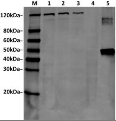 Streptococcus pyogenes CRISPR-associated endonuclease Cas9/Csn1 Antibody - Western Blot of Hela transfected with PX458 (SaCas9(BB)-2A-GFP) or untransfected cell lysates with SaCas9 Antibody (11C12). The different concentration of cell lysates indicates the high affinity and sensitivity of the antibody. Predicted band size: 124 kDa. Predicted band size of recombinant protein: 47.5 kDa. Loading: Lane 1: 50 µg Hela transfected with SaCas9(BB)-2A-GFP cell Lysate. Lane 2: 25 µg Hela transfected with SaCas9(BB)-2A-GFP cell Lysate. Lane 3: 10 µg Hela transfected with SaCas9(BB)-2A-GFP cell Lysate. Lane 4: 50 µg Untransfected Hela cell Lysate. Lane 5: 40 ng SaCas9 recombinant protein. Primary Antibody: SaCas9 Antibody (11C12) 1 µg/ml. Secondary Antibody: Goat anti-Mouse IgG (H&L) [IRDye800] 0.125 µg/ml.