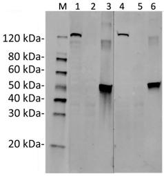 Streptococcus pyogenes CRISPR-associated endonuclease Cas9/Csn1 Antibody - Western Blot of Hela transfected with PX458 (SaCas9(BB)-2A-GFP) or untransfected cell lysates with two independent antibodies: SaCas9 Antibody (11C12) and SaCas9 Antibody (26H10). The correlated pattern indicates the high specificity of these two antibodies. Predicted band size: 124 kDa. Predicted band size of recombinant protein: 47.5 kDa. Loading: Lane 1: 50 µg Hela transfected with SaCas9(BB)-2A-GFP cell Lysate. Lane 2: 50 µg Untransfected Hela cell Lysate. Lane 3: 40 ng SaCas9 recombinant protein. Lane 4: 50 µg Hela transfected with SaCas9(BB)-2A-GFP cell Lysate. Lane 5: 50 µg Untransfected Hela cell Lysate. Lane 6: 40 ng SaCas9 recombinant protein. Primary Antibody: Lane 1~3: SaCas9 Antibody (11C12) 1 µg/ml. Lane 4~6: SaCas9 Antibody (26H10) 1 µg/ml. Secondary Antibody: Goat anti-Mouse IgG (H&L) [IRDye800] 0.125 µg/ml.