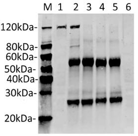 Streptococcus pyogenes CRISPR-associated endonuclease Cas9/Csn1 Antibody - Immunoprecipitation of SaCas9 from Hela cell transfected with PX458 (SaCas9(BB)-2A-GFP) by using  SaCas9 Antibody (26H10). Predicted band size: 124 kDa. Loading: Lane 1: Hela cell lysate transfected with PX458 (SaCas9(BB)-2A-GFP) 50µg (Input). Lane 2: Protein A MagBeads (20µl) + Purified antibody (10µg) + Hela cell lysate transfected with PX458 (SaCas9(BB)-2A-GFP) (200µg). Lane 3: Protein A MagBeads (20µl) + Purified antibody (10µg) + Hela cell lysate (200µg). Lane 4: Protein A MagBeads (20µl) + Mouse IgG (10µg) + Hela cell lysate transfected with PX458 (SaCas9(BB)-2A-GFP) (200µg). Lane 5: Protein A MagBeads (20µl) + Mouse IgG (10µg) + Hela Cell lysate (200µg). Lane 6: Hela Cell lysate (50µg). Primary Antibody: SaCas9 Antibody (26H10) 1 µg/ml. Secondary antibody: Goat anti-Mouse IgG (H&L) [IRDye800] 0.125 µg/ml.