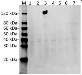 Streptococcus pyogenes CRISPR-associated endonuclease Cas9/Csn1 Antibody - Western Blot analysis of Hela transfected with various plasmids with SaCas9 Antibody (26H10). The different Hela transfected with various plasmids indicate the minimum cross reaction of the antibody. Predicted band size: 124 kDa. Loading: Lane 1: 50µg Hela cell lysate transfected with StCas9(BB)-2A-GFP (G3ECR1, Streptococcus thermophiles). Lane 2: 50µg Hela cell lysate transfected with pSpCas9(BB)-2A-GFP (PX458, Q99ZW2, Streptococcus pyogenes serotype M1). Lane 3: 50µg Hela cell lysate transfected with SaCas9(BB)-2A-GFP (J7RUA5, Staphylococcus aureus). Lane 4: 50µg Hela cell lysate transfected with AsCpf1(BB)-2A-GFP (U2UMQ6, Acidaminococcus sp. (strain BV3L6)). Lane 5: 50µg Hela cell lysate transfected with FnCpf1(BB)-2A-GFP (A0Q7Q2, Francisella tularensis subsp. novicida (strain U112)). Lane 6: 50µg Hela cell lysate transfected with LbCpf1(BB)-2A-GFP (Lachnospiraceae bacterium ND2006). Lane 7: 50µg Hela cell lysate (Non-transfected). Primary Antibody: Lane 1~7: SaCas9 Antibody (26H10) 1 µg/ml. Secondary antibody: Goat anti-Mouse IgG (H&L) [IRDye800] 0.125 µg/ml.