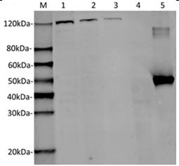 Streptococcus pyogenes CRISPR-associated endonuclease Cas9/Csn1 Antibody - Western Blot of Hela transfected with PX458 (SaCas9(BB)-2A-GFP) or untransfected cell lysates with SaCas9 Antibody (26H10). The different concentration of cell lysates indicates the high affinity and sensitivity of the antibody. Predicted band size: 124 kDa. Predicted band size of recombinant protein: 47.5 kDa. Loading: Lane 1: 50 µg Hela transfected with SaCas9(BB)-2A-GFP cell Lysate. Lane 2: 25 µg Hela transfected with SaCas9(BB)-2A-GFP cell Lysate. Lane 3: 10 µg Hela transfected with SaCas9(BB)-2A-GFP cell Lysate. Lane 4: 50 µg Untransfected Hela cell Lysate. Lane 5: 40 ng SaCas9 recombinant protein. Primary Antibody: SaCas9 Antibody (26H10) 1 µg/ml. Secondary Antibody: Goat anti-Mouse IgG (H&L) [IRDye800] 0.125 µg/ml.