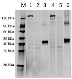 Streptococcus pyogenes CRISPR-associated endonuclease Cas9/Csn1 Antibody - Western Blot of HEK293 transfected with PX458 (pSpCas9(BB)-2A-GFP) or untransfected cell lysates with two independent antibodies: SpCas9 Antibody (4A1) and SpCas9 Antibody (14B6). The correlated pattern indicates the high specificity of these two antibodies. Lane 1: 50 µg HEK293 transfected with PX458 cell Lysate. Lane 2: 50 µg Untransfected HEK293 cell Lysate. Lane 3: 40 ng SpCas9 recombinant protein. Lane 4: 50 µg HEK293 transfected with PX458 cell Lysate. Lane 5: 50 µg Untransfected HEK293 cell Lysate. Lane 6: 40 ng SpCas9 recombinant protein. Primary Antibody: Lane 1~3: SpCas9 Antibody (4A1) 1 µg/ml. Lane 4~6: SpCas9 Antibody (14B6) 1 µg/ml. Secondary Antibody: Goat anti-Mouse IgG (H&L) [IRDye800] 0.125 µg/ml.