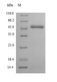 CTPS Protein - (Tris-Glycine gel) Discontinuous SDS-PAGE (reduced) with 5% enrichment gel and 15% separation gel.