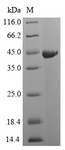 speB Protein - (Tris-Glycine gel) Discontinuous SDS-PAGE (reduced) with 5% enrichment gel and 15% separation gel.