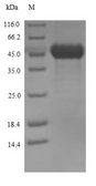 Streptolysin O Protein - (Tris-Glycine gel) Discontinuous SDS-PAGE (reduced) with 5% enrichment gel and 15% separation gel.