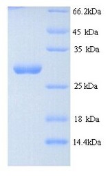 nosM Protein