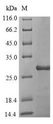 Alpha-amylase inhibitor HOE-467A Protein - (Tris-Glycine gel) Discontinuous SDS-PAGE (reduced) with 5% enrichment gel and 15% separation gel.