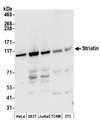 STRN / Striatin Antibody - Detection of human and mouse Striatin by western blot. Samples: Whole cell lysate (50 µg) from HeLa, HEK293T, Jurkat, mouse TCMK-1, and mouse NIH 3T3 cells prepared using NETN lysis buffer. Antibodies: Affinity purified rabbit anti-Striatin antibody used for WB at 0.1 µg/ml. Detection: Chemiluminescence with an exposure time of 30 seconds.
