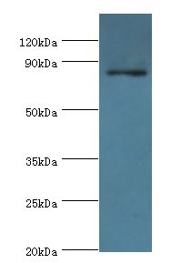STRN / Striatin Antibody - Western blot. All lanes: STRN antibody at 3 ug/ml+NIH3T3 whole cell lysate. Secondary antibody: Goat polyclonal to rabbit at 1:10000 dilution. Predicted band size: 86 kDa. Observed band size: 86 kDa.