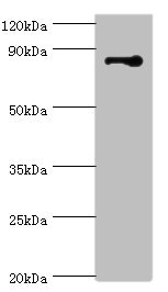 STRN / Striatin Antibody - Western blot All lanes: STRN antibody at 3µg/ml + NIH/3T3 whole cell lysate Secondary Goat polyclonal to rabbit IgG at 1/10000 dilution Predicted band size: 87, 81 kDa Observed band size: 87 kDa