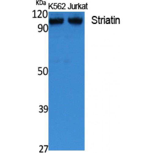 STRN / Striatin Antibody - Western blot of Striatin antibody