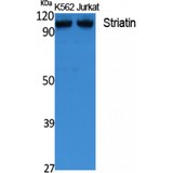 STRN / Striatin Antibody - Western blot of Striatin antibody