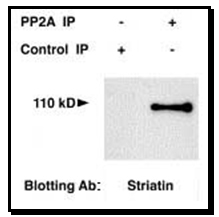 STRN / Striatin Antibody - Western Blot of PP2A immunoprecipitate.
